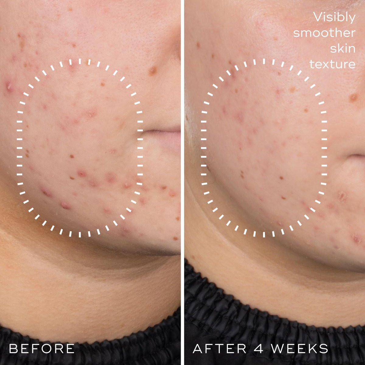 Medik8 Niacinamide Peptides Serum – Gesichtsserum für klare Haut, verfeinerte Textur und reduzierte Poren – Feuchtigkeitsspendend mit regulierter Talgproduktion – 30 ml