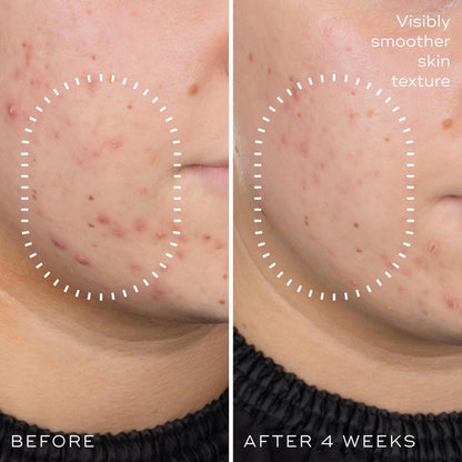 Medik8 Niacinamide Peptides Serum – Gesichtsserum für klare Haut, verfeinerte Textur und reduzierte Poren – Feuchtigkeitsspendend mit regulierter Talgproduktion – 30 ml