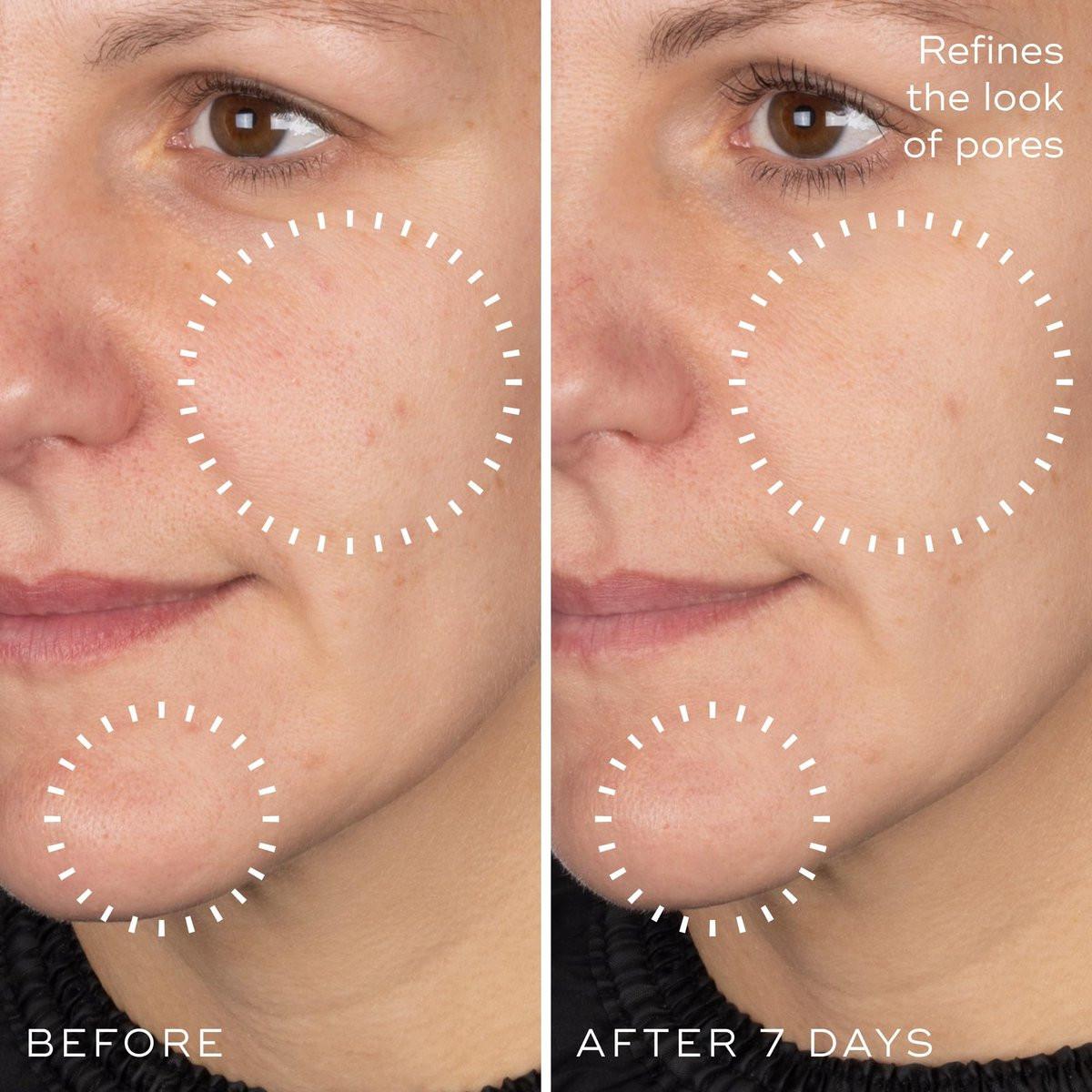 Medik8 Niacinamide Peptides Serum – Gesichtsserum für klare Haut, verfeinerte Textur und reduzierte Poren – Feuchtigkeitsspendend mit regulierter Talgproduktion – 30 ml