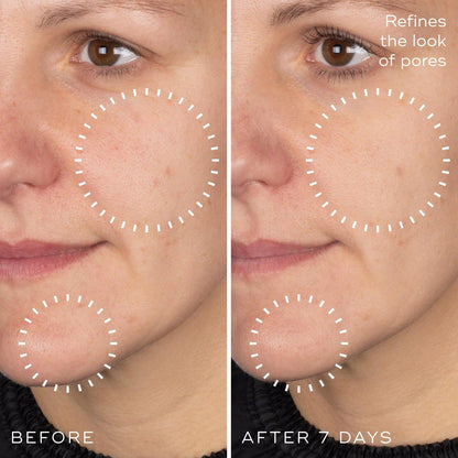 Medik8 Niacinamide Peptides Serum – Gesichtsserum für klare Haut, verfeinerte Textur und reduzierte Poren – Feuchtigkeitsspendend mit regulierter Talgproduktion – 30 ml