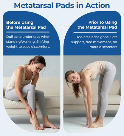 MasterMo Metatarsal-Pads für Männer und Frauen – Ballenpolster zur Schmerzlinderung bei Sesamoiditis, Metatarsalgie, Morton-Neurom – 2 Paar Stoffhüllen mit Gel-Einlagen (Schwarz, M)