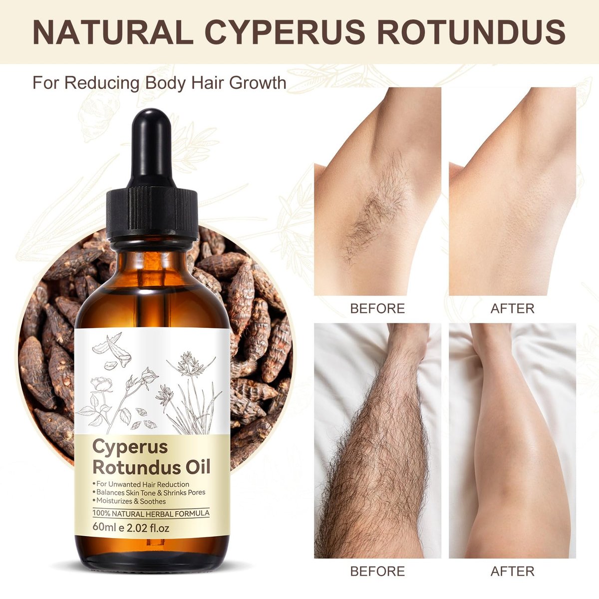Cyperus Rotundus Öl – Premium Zyperngrasöl für sanfte Haarentfernung, Porenverfeinerung und glatte Haut
