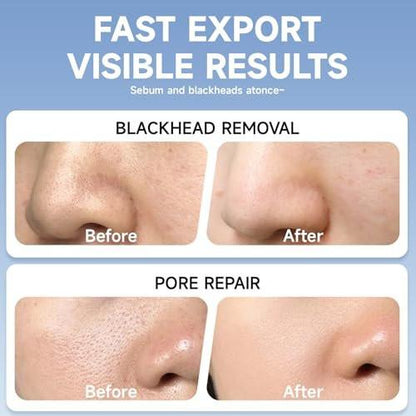 2 in 1 PDRN & Calcium BlackHead Melting & Porenminimierer, 10,15 fl oz | 60 Hautpflege-Wattepads, schmilzt Talg, strafft Poren, Ölkontrolle + Feuchtigkeitsversorgung | Hyaluronsäure, Salicylsäure, Koreanische Hautpflege