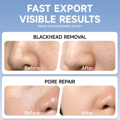 2 in 1 PDRN & Calcium BlackHead Melting & Porenminimierer, 10,15 fl oz | 60 Hautpflege-Wattepads, schmilzt Talg, strafft Poren, Ölkontrolle + Feuchtigkeitsversorgung | Hyaluronsäure, Salicylsäure, Koreanische Hautpflege