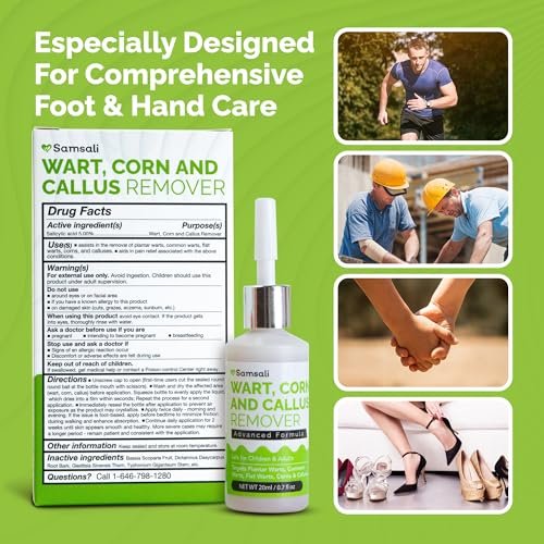 Samsali Flüssiger Plantarwarzenentferner: 20 ml Salicylsäure-Lösung zur Entfernung von Plantarwarzen, Dornwarzen, Hühneraugen und Hornhaut an Füßen, Zehen und Händen – Sicher für Jugendliche, Erwachsene, Senioren, Männer und Frauen