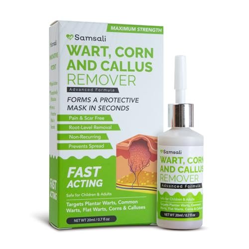 Samsali Flüssiger Plantarwarzenentferner: 20 ml Salicylsäure-Lösung zur Entfernung von Plantarwarzen, Dornwarzen, Hühneraugen und Hornhaut an Füßen, Zehen und Händen – Sicher für Jugendliche, Erwachsene, Senioren, Männer und Frauen