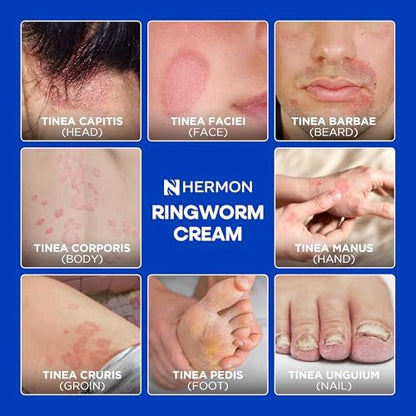Hermon Antimykotische Reinigungsseife für Ringelflechte – Tägliches Duschgel gegen Fußpilz & Jock Itch – Teebaumöl & Schwefel Formel – Sanfte Hautbarrierepflege – 2er Pack