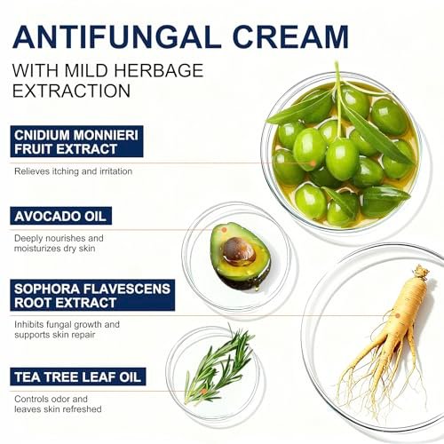 Kerova Antimykotikum-Creme gegen Jock Juckreiz, Fußpilz und Ringelflechte – 2% Miconazolnitrat-Creme für Hautpilz beim Menschen, lindert Juckreiz, Brennen, Risse und Schuppen (99 ml)