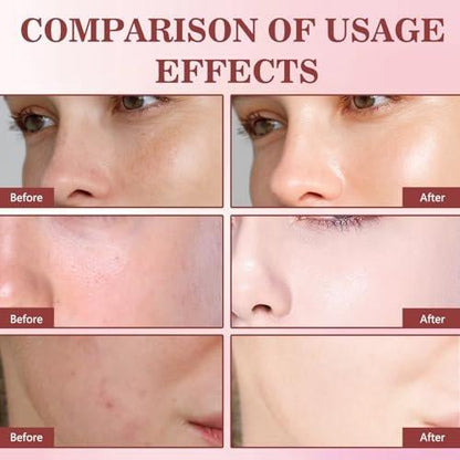 2er-Pack Drachenblut-Retinol-Creme – Anti-Falten-Creme für straffe, jugendliche Haut, Feuchtigkeitscreme für alle Hauttypen (0,88 Unzen x 2)