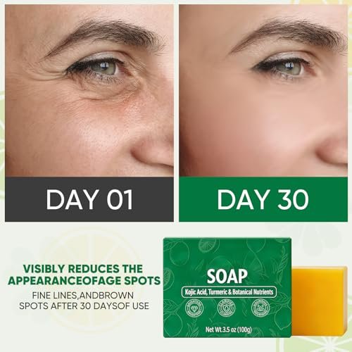 Finturo 2er-Pack Soul Superfood Seifenbarren – Verfeinerte Kurkuma-Zitronen-Seife für Gesicht und Körper, geeignet für trockene und fettige Haut