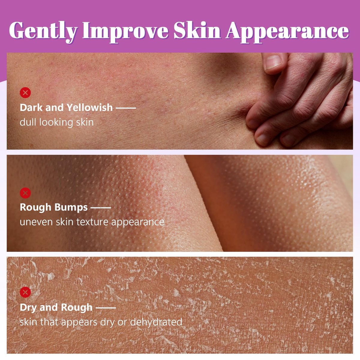Glykolsäure-Peeling-Körperstick – Mit Glykolsäure & Salicylsäure, glättet raue Haut, für sanftes Körperpeeling