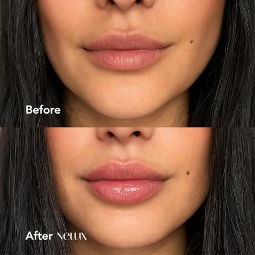 Nelux Lip Plumper mit Hyaluronsäure – Sofortige Hydratation & sichtbar vollere Lippen ohne Kleben oder Kribbeln