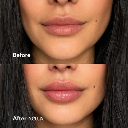 Nelux Lip Plumper mit Hyaluronsäure – Sofortige Hydratation & sichtbar vollere Lippen ohne Kleben oder Kribbeln