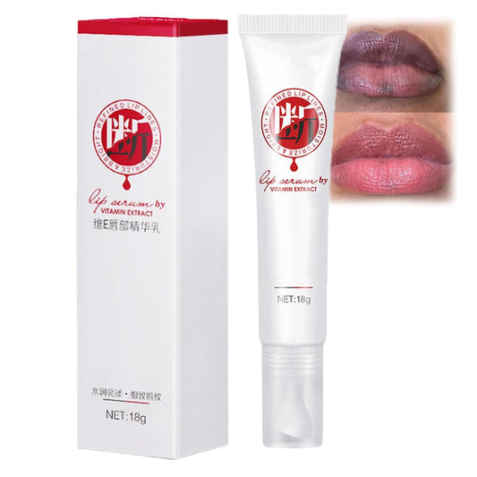 Lippenaufhellung für dunkle Lippen – Lippenhellungsserum mit Vitamin C, Jojobaöl & Süßholz für natürliche Farbe und Feuchtigkeit