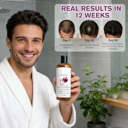 warmow Zwiebel Shampoo mit Rosmarinöl, roter Zwiebel & Zimtextrakt – Stärkt die Haarwurzeln, reduziert Haarausfall, fördert das Haarwachstum für Männer und Frauen, 200 ml