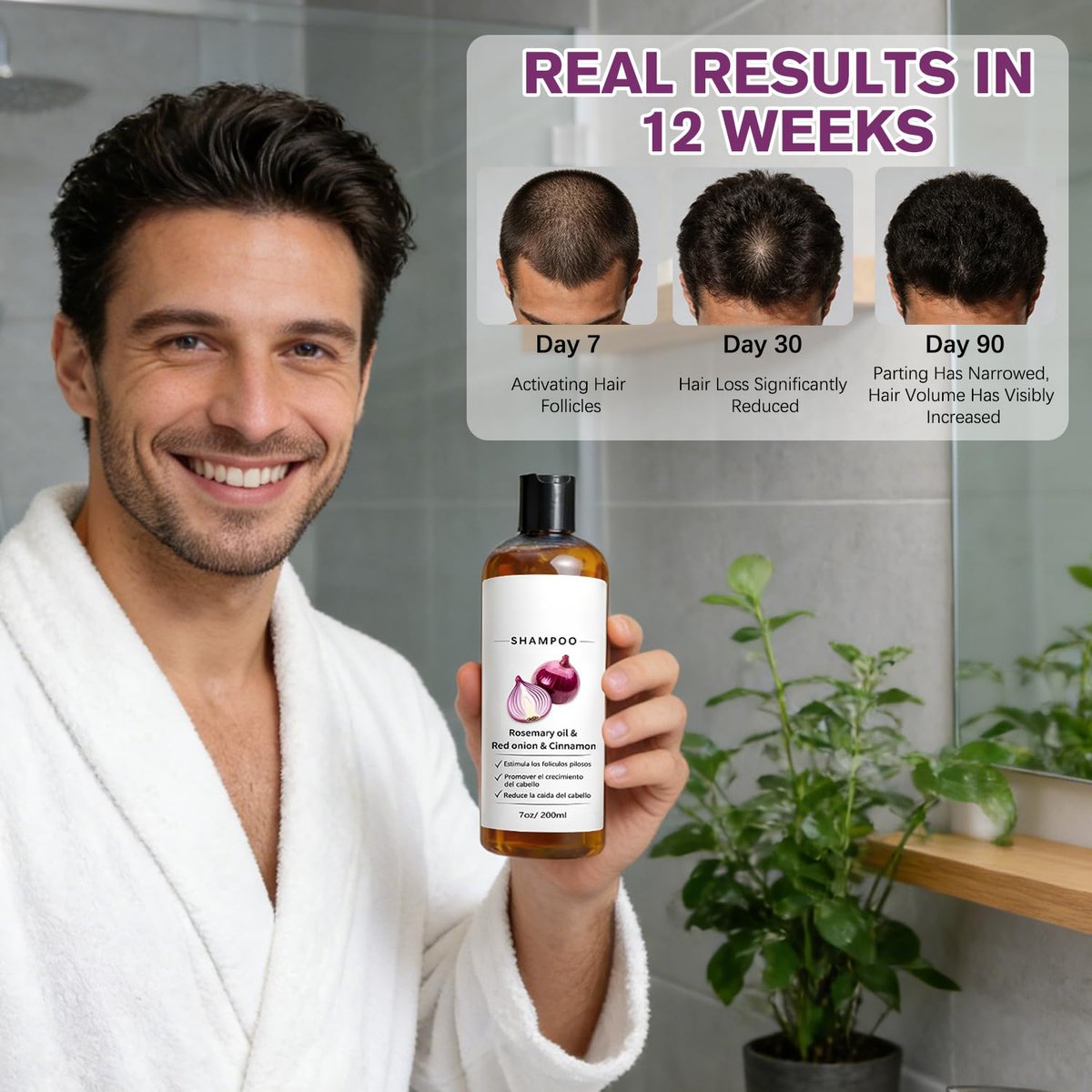 warmow Zwiebel Shampoo mit Rosmarinöl, roter Zwiebel & Zimtextrakt – Stärkt die Haarwurzeln, reduziert Haarausfall, fördert das Haarwachstum für Männer und Frauen, 200 ml