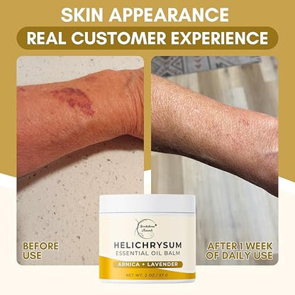 Brookethorne Naturals Helichrysum-Balsam | Hochkonzentrierter Helichrysum-Balsam für empfindliche Haut | mit Arnika, Rizinusöl & Lavendel | 60 ml