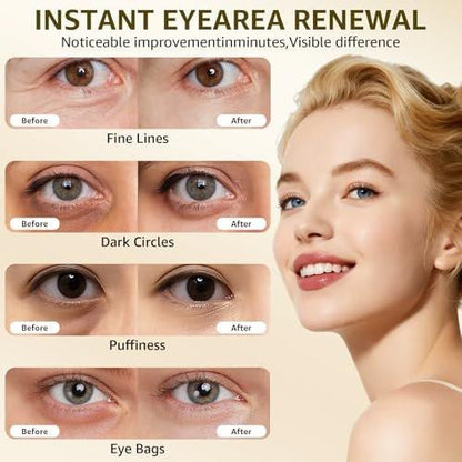 15S Instant Eye Tightener Cream – Firmx Eye & Face Cream mit PDRN, Panthenol, 0,7 Fl Oz – Sofortige Straffung für Augenringe, Tränensäcke & Falten