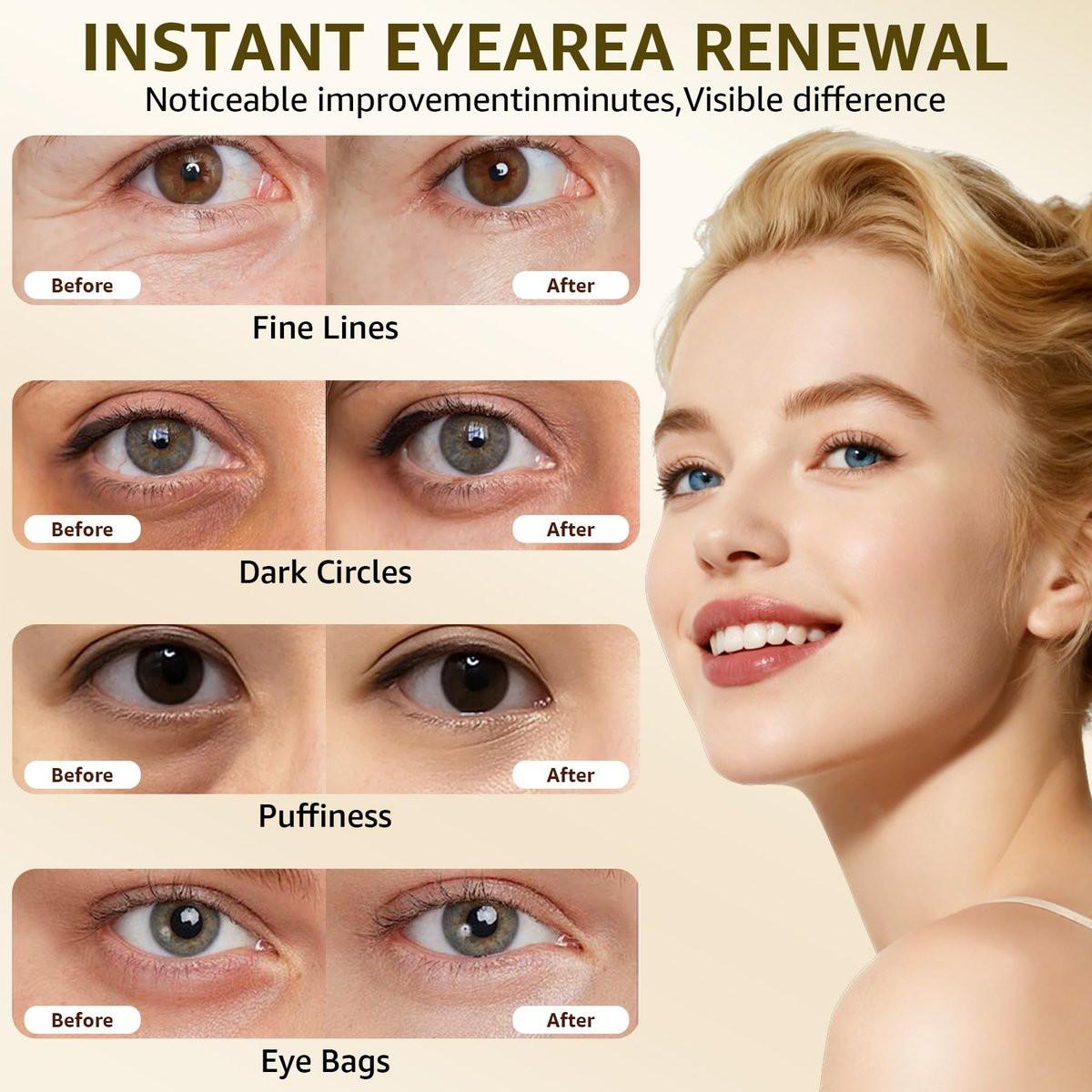 15S Instant Eye Tightener Cream – Firmx Eye & Face Cream mit PDRN, Panthenol, 0,7 Fl Oz – Sofortige Straffung für Augenringe, Tränensäcke & Falten