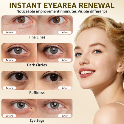 15S Instant Eye Tightener Cream – Firmx Eye & Face Cream mit PDRN, Panthenol, 0,7 Fl Oz – Sofortige Straffung für Augenringe, Tränensäcke & Falten