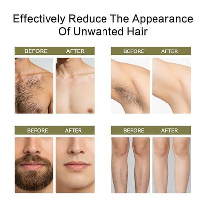 Cyperus Rotundus Öl zur Haarentfernung: 100% reiner natürlicher Haarwuchshemmer Serum, 60 Sekunden schnelle Absorption, verkleinert Poren, beugt eingewachsenen Haaren vor, feuchtigkeitsspendend & beruhigend für alle Hauttypen, 2 Stück