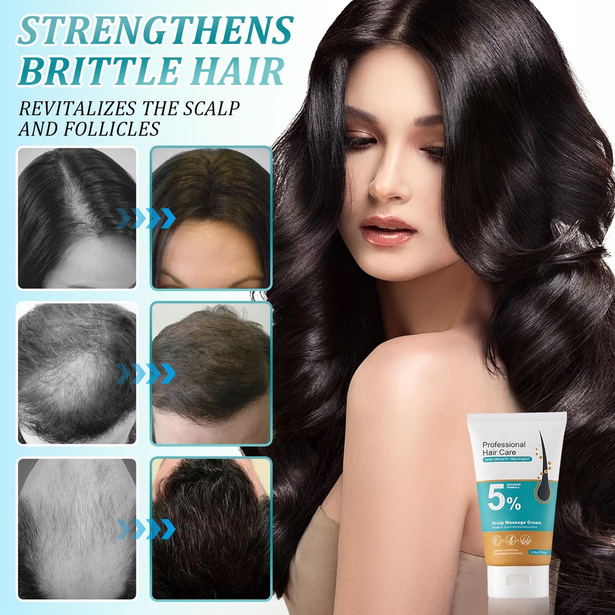 2er-Pack 5% Haarwuchs Kopfhautmassage-Creme, Professionelle Haarpflege-Creme gegen Haarausfall mit Rosmarin und Biotin für Männer und Frauen, Stärkt Haarwurzeln und fördert schnelles Nachwachsen