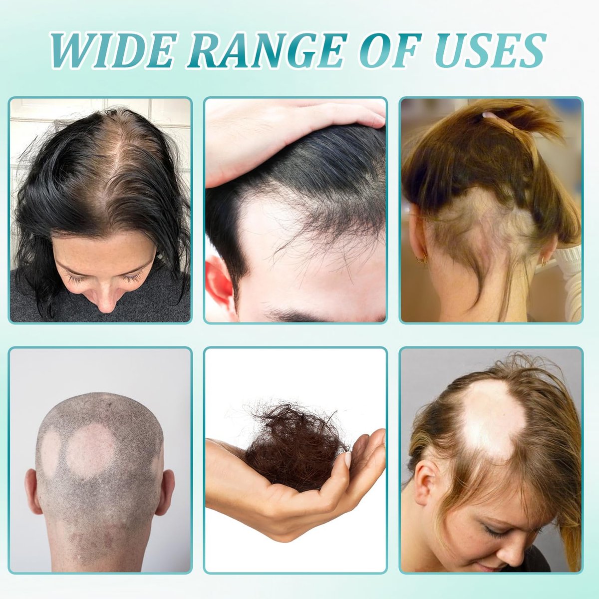 2er-Pack 5% Haarwuchs Kopfhautmassage-Creme, Professionelle Haarpflege-Creme gegen Haarausfall mit Rosmarin und Biotin für Männer und Frauen, Stärkt Haarwurzeln und fördert schnelles Nachwachsen