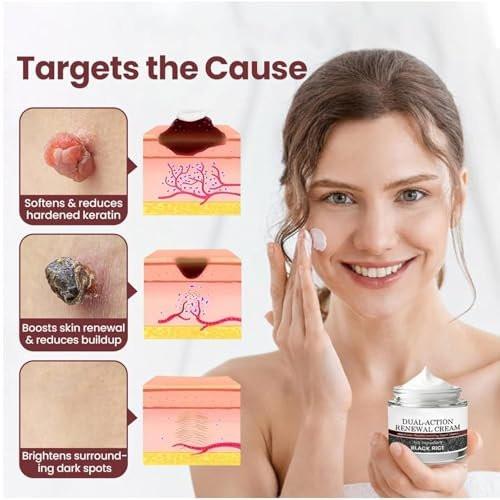 HTKINMI Dual-Action Renewal Cream – Schwarz-Weiß-Reis Pflegecreme mit Schwarzreis & Keratinkontrolle für alle Hauttypen (50 ml)