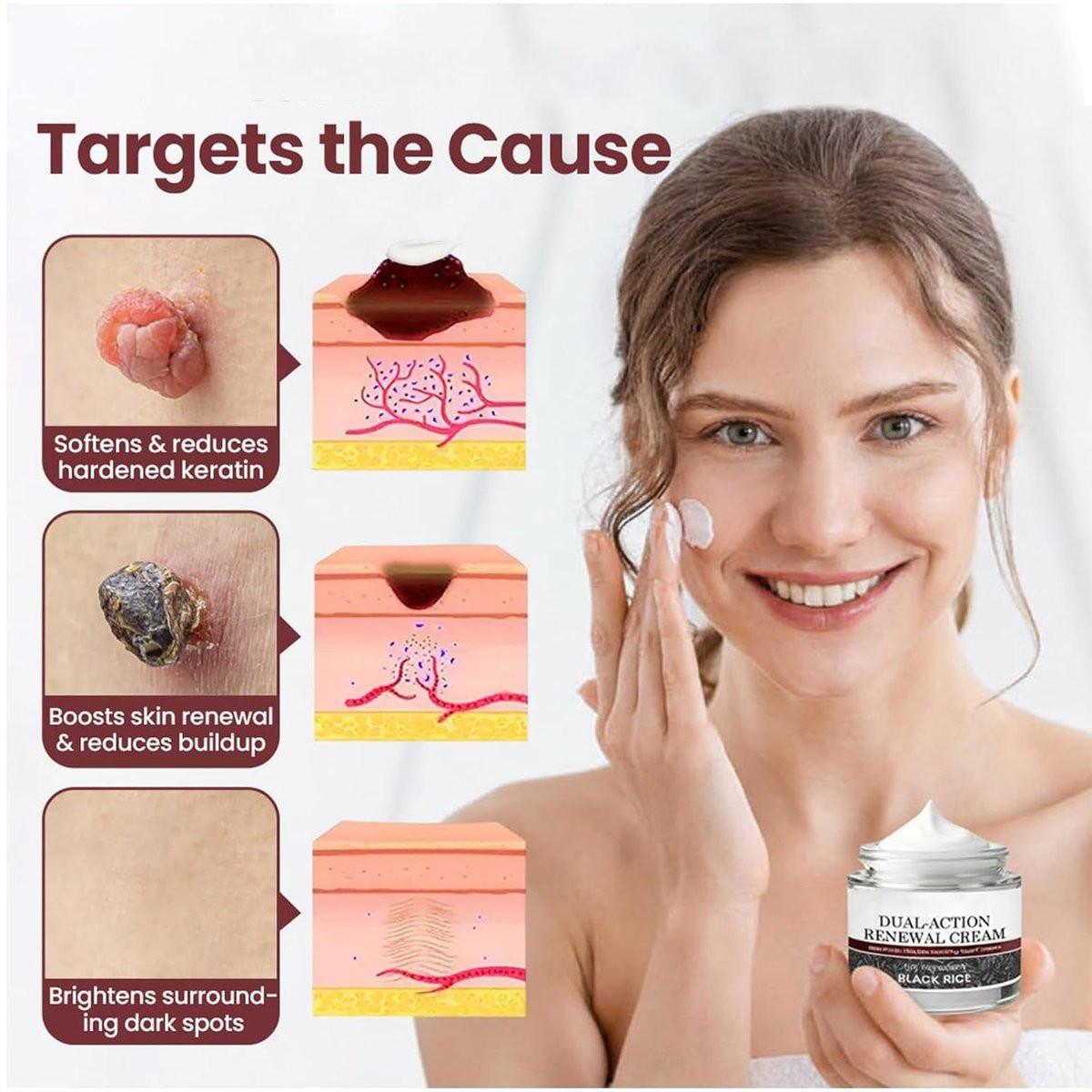 HTKINMI Dual-Action Renewal Cream – Schwarz-Weiß-Reis Pflegecreme mit Schwarzreis & Keratinkontrolle für alle Hauttypen (50 ml)