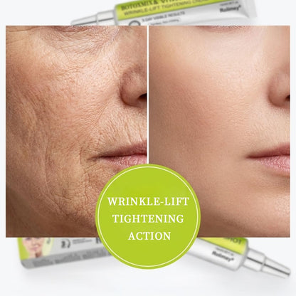 Botoxmix & Vita-A Retinol Shot Faltenglättende Straffungscreme, Fortschrittliche Retinol Körperlotion, Anti-Falten Creme - Natürlicher Porenverfeinerer für alle Hauttypen, 15 ml (2 Flaschen)
