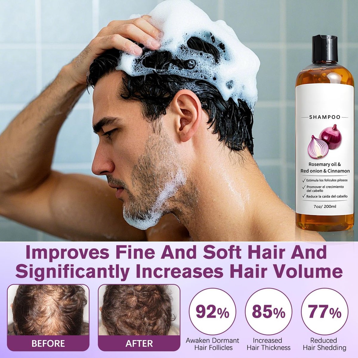 Zwiebel-Shampoo für Männer mit Rosmarinöl, rote Zwiebel, Zimtextrakt – Stärkt Haarwurzeln, fördert Haarwachstum, beugt Haarausfall vor – für dickeres und längeres Haar (2 Liter)