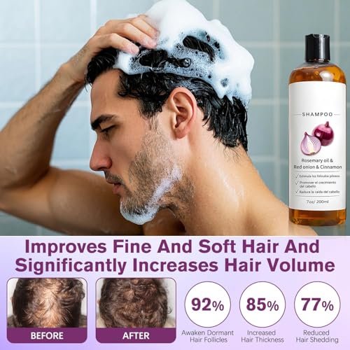 Zwiebel-Shampoo für Männer mit Rosmarinöl, rote Zwiebel, Zimtextrakt – Stärkt Haarwurzeln, fördert Haarwachstum, beugt Haarausfall vor – für dickeres und längeres Haar (2 Liter)