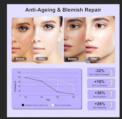 XANBYYE Rotlichttherapie-Gesichtsmaske – Anti-Aging LED-Maske mit 7 Farben und einstellbarer Helligkeit, wiederaufladbar für zu Hause