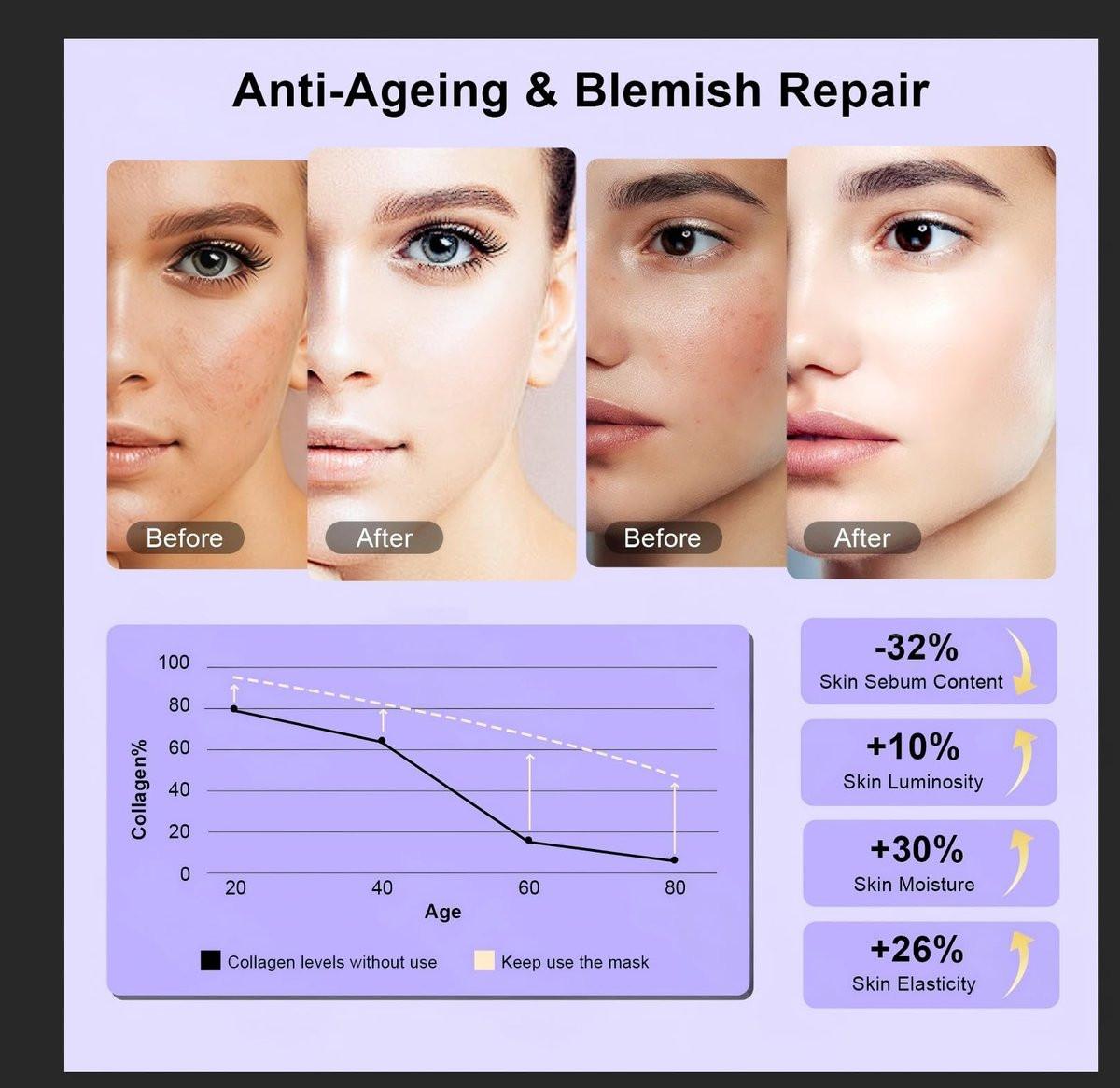 XANBYYE Rotlichttherapie-Gesichtsmaske – Anti-Aging LED-Maske mit 7 Farben und einstellbarer Helligkeit, wiederaufladbar für zu Hause