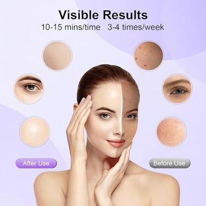 XANBYYE Rotlichttherapie-Gesichtsmaske – Anti-Aging LED-Maske mit 7 Farben und einstellbarer Helligkeit, wiederaufladbar für zu Hause