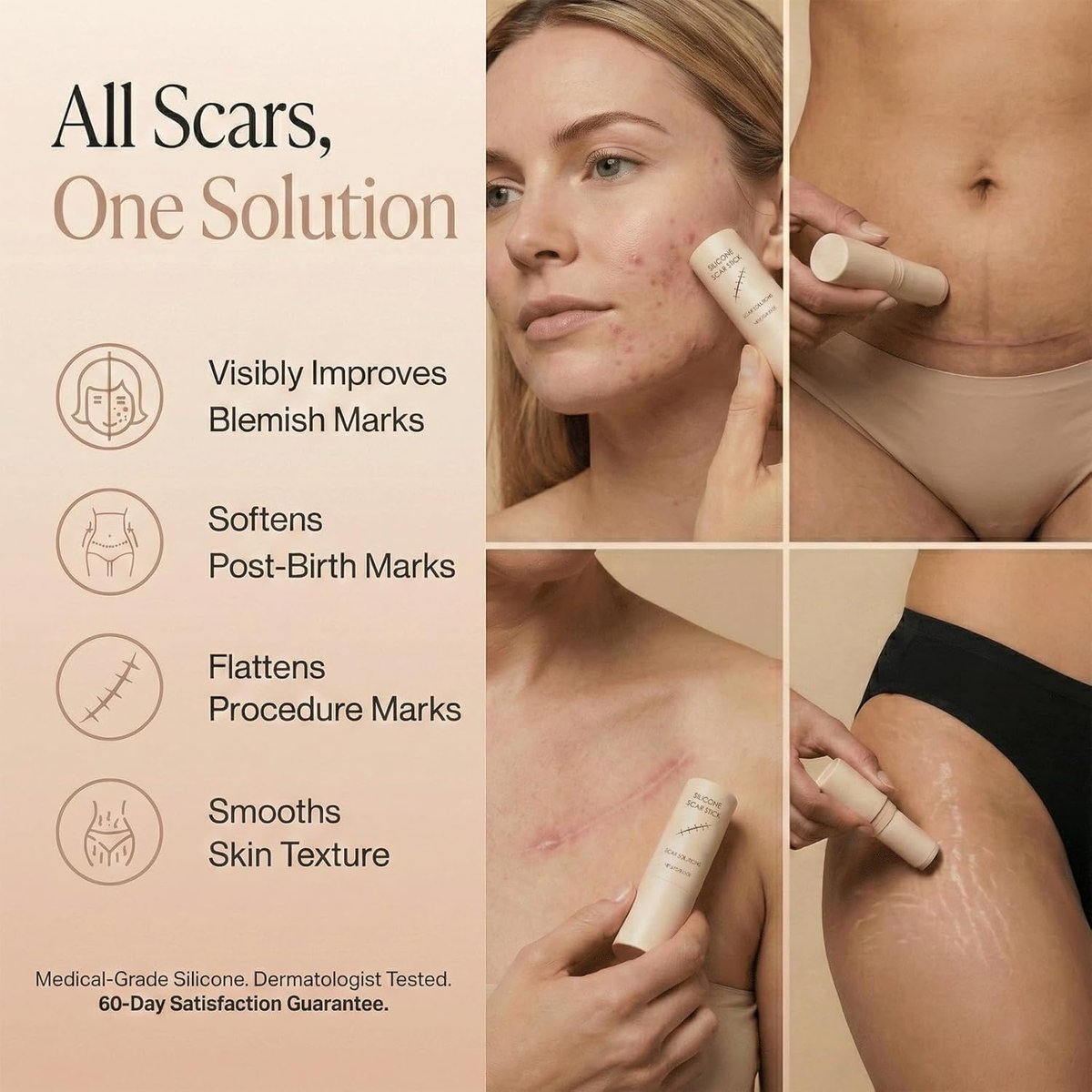 Pluune Scar Stick – Geeignet für alte Narben, Aknemale und Dehnungsstreifen – Formel mit Centella Asiatica und Vitamin E – Pflegt, repariert und bildet einen Schutzfilm (2)