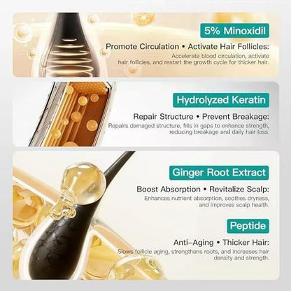 5% Minoxidil Haarwachstum Kopfhautmassage Creme, Anti Haarausfall Behandlung Minoxidil für Männer & Frauen, Schnelles Nachwachsen & Stärkung der Haarwurzeln, Aktiviert Follikel (2er Pack)
