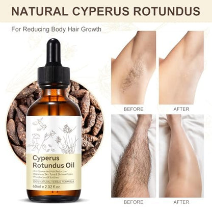 Cyperus Rotundus Öl zur Haarentfernung – 100% rein & natürlich, reduziert Körperbehaarung, spendet Feuchtigkeit & beruhigt die Haut, für alle Hauttypen