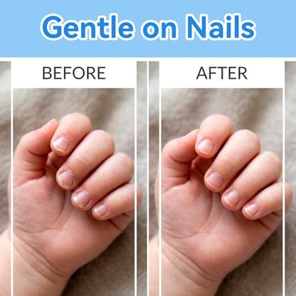 Elektrische Nagelfeilen-Aufsätze für Babys, 12 Stück, Ersatz-Schleifköpfe kompatibel mit Frida Baby Nagelfeile (Grün: 6-12 Monate; Blau: 12+ Monate)