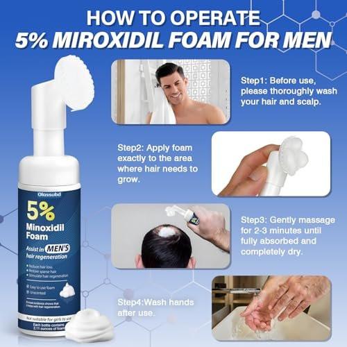 Minoxidil 5% Schaum für Männer – Haarwachstum, gegen Haarausfall und lichte Stellen