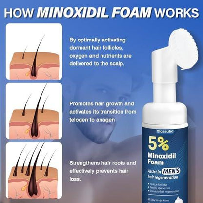Minoxidil 5% Schaum für Männer – Haarwachstum, gegen Haarausfall und lichte Stellen