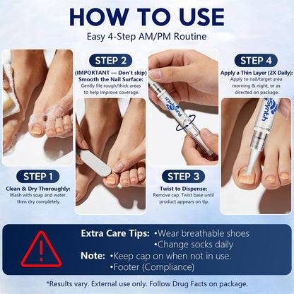 Extra Starkes Nagelpilz-Reparatur-Pen (OTC Maximalstärke), 25% Undecylensäure + Aloe & Vitamin E, für dicke gelb verfärbte Nägel, 12 ml (0,41 fl oz) Gesamt, 4er-Pack, Designed in USA