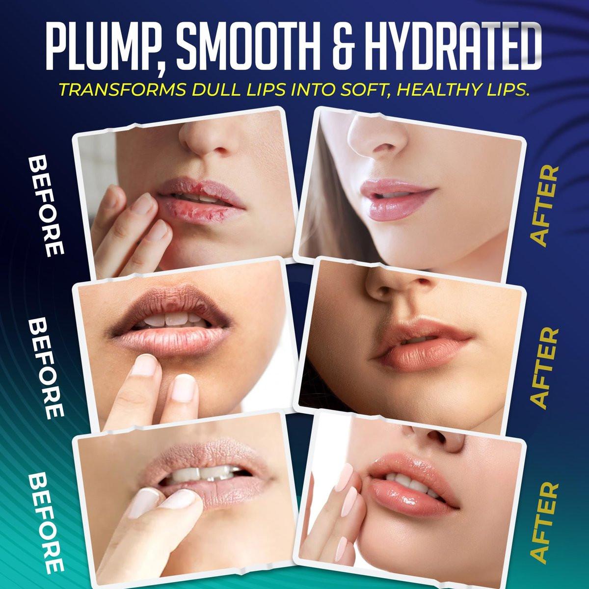 LipLocked 30er-Pack Kollagen-Lippenmasken – Pflegende Lippenmasken mit Aloe Vera, CoQ10, Vitamin B5, B7 & E – Anti-Falten & Anti-Aging Behandlung für weiche, glatte Lippen im Schlaf