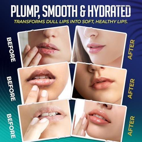 LipLocked 30er-Pack Kollagen-Lippenmasken – Pflegende Lippenmasken mit Aloe Vera, CoQ10, Vitamin B5, B7 & E – Anti-Falten & Anti-Aging Behandlung für weiche, glatte Lippen im Schlaf