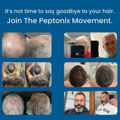 Peptonix Kupferpeptid-Serum-System – Für voller aussehendes, dichter wirkendes Haar und eine gesunde Kopfhaut (3-Monats-Vorrat)