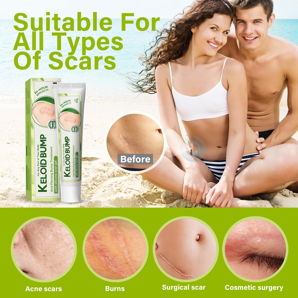 Keloid-Narbenentfernungs-Creme, Silikon-Aknenarben-Gel, sanfte & wirksame Nachsorge bei Verletzungen & Operationen, Hautreparatur für Gesicht & Körper