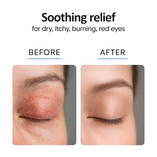 Aquia Augenlid-Reinigungsspray 8oz | Blepharitis Behandlung | Stye Behandlung | Hypochlorige Säure für trockene Augen, Demodex, Chalazion, MGD, Milben | Lid- und Wimpernreiniger