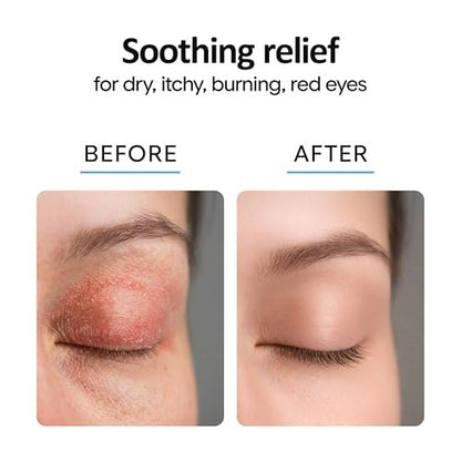 Aquia Augenlid-Reinigungsspray 8oz | Blepharitis Behandlung | Stye Behandlung | Hypochlorige Säure für trockene Augen, Demodex, Chalazion, MGD, Milben | Lid- und Wimpernreiniger