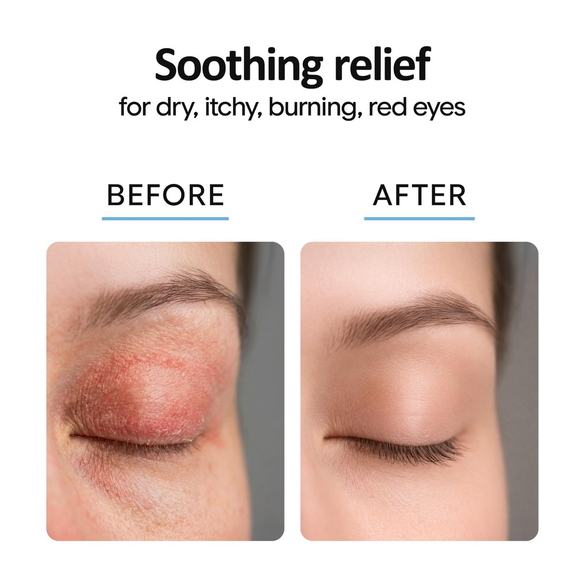 Aquia Augenlid-Reinigungsspray 8oz | Blepharitis Behandlung | Stye Behandlung | Hypochlorige Säure für trockene Augen, Demodex, Chalazion, MGD, Milben | Lid- und Wimpernreiniger