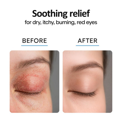Aquia Augenlid-Reinigungsspray 8oz | Blepharitis Behandlung | Stye Behandlung | Hypochlorige Säure für trockene Augen, Demodex, Chalazion, MGD, Milben | Lid- und Wimpernreiniger